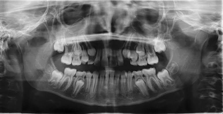 WhatsApp Image 2023-03-11 at 00.57.09